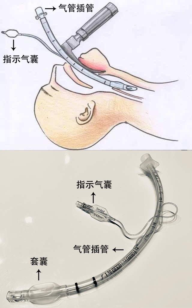 贊?。?！250萬指示氣囊，客戶100%滿意！